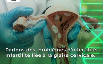 Parlons des problèmes d’infertilité liés à la glaire cervicale