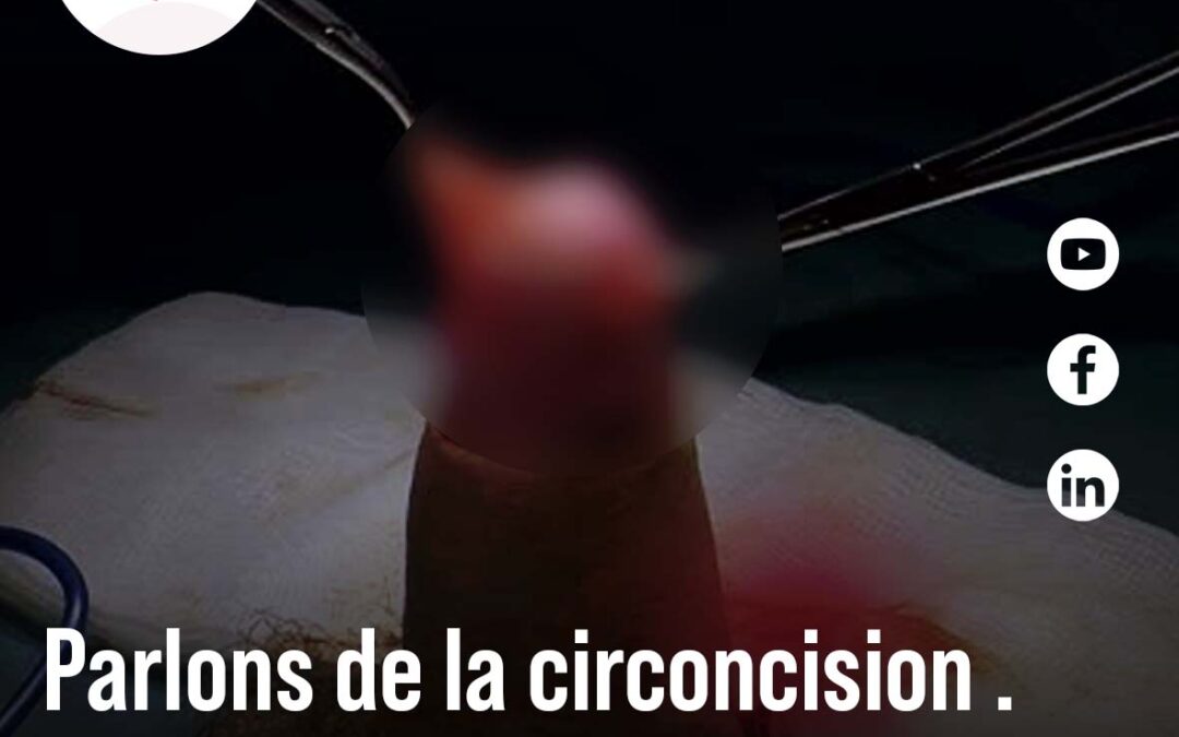 La circoncision