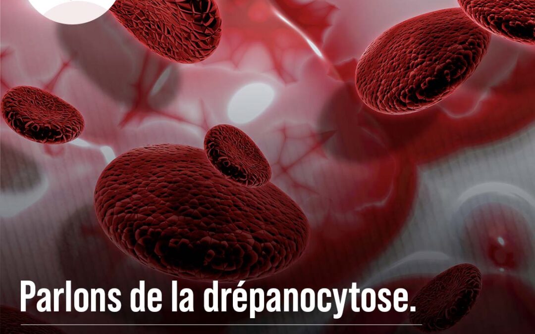 La Drépanocytose