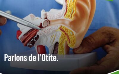 Otite