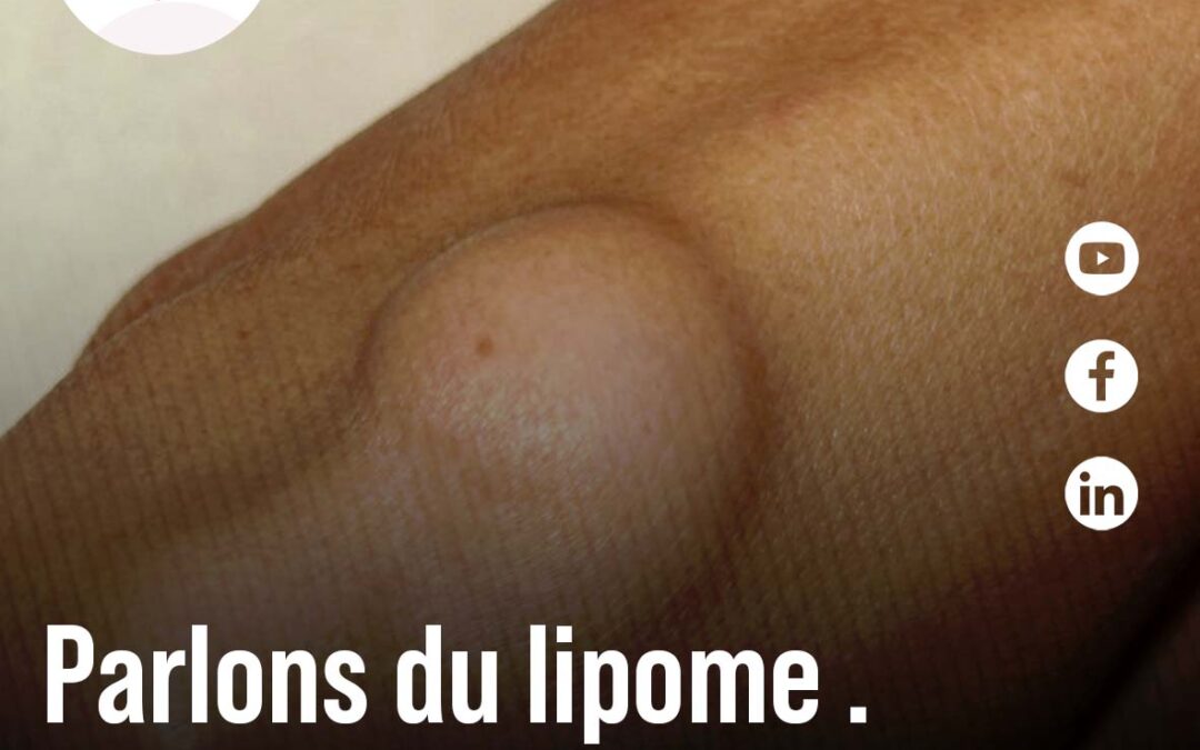 Parlons du Lipome