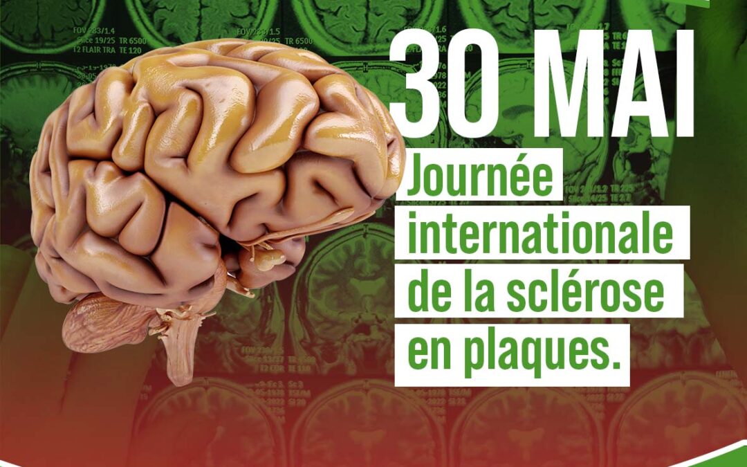 de la sclérose en plaques
