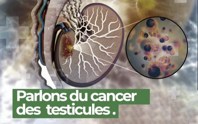 Le cancer des testicules : Parlons-en pour mieux le prévenir