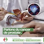 le cancer de la prostate