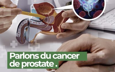 Comprendre le cancer de la prostate : un enjeu majeur de santé masculine