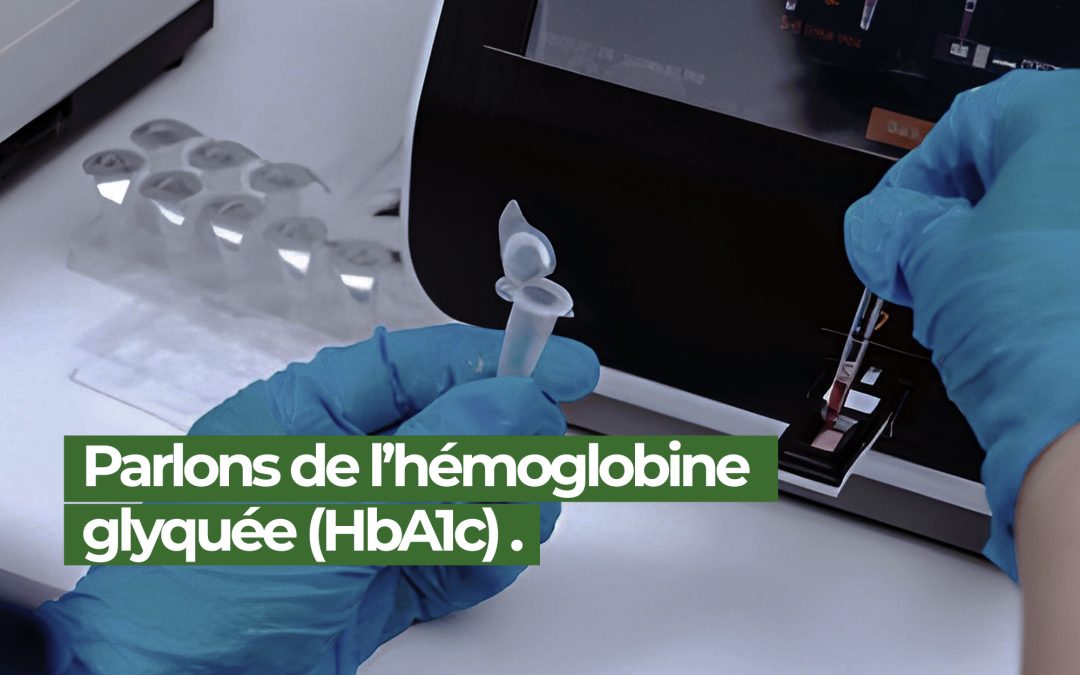 Hémoglobine glyquée : intérêt clinique