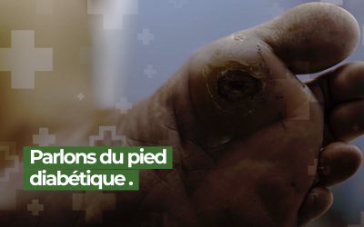 Le Pied Diabetique