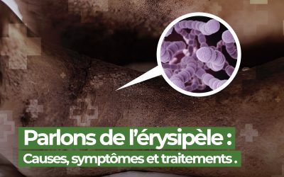 Zoom sur l’érysipèle : une infection cutanée à ne pas négliger