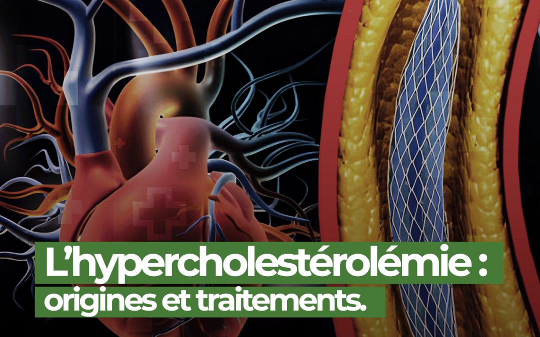 Hypercholestérolémie : ce qu’il faut savoir