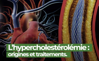 Hypercholestérolémie : ce qu’il faut savoir