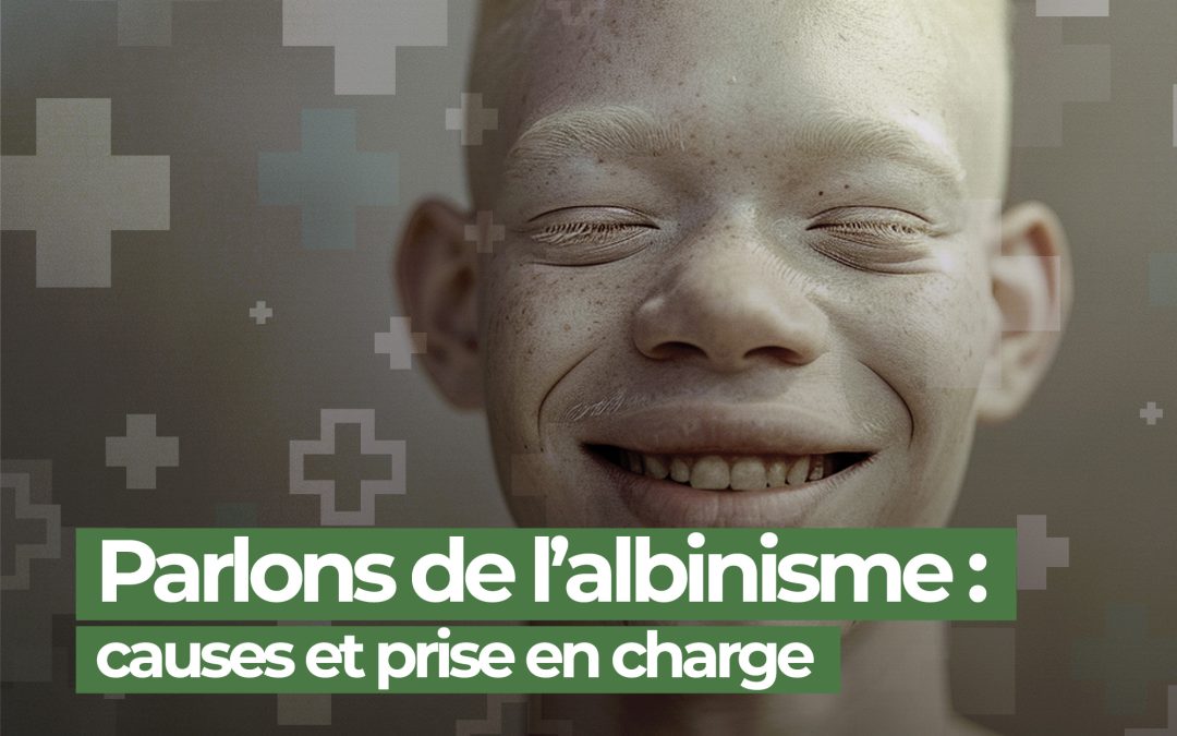 Parlons de l’albinisme